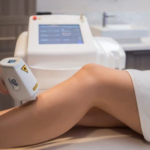 Hair Removal — Laserska epilacija