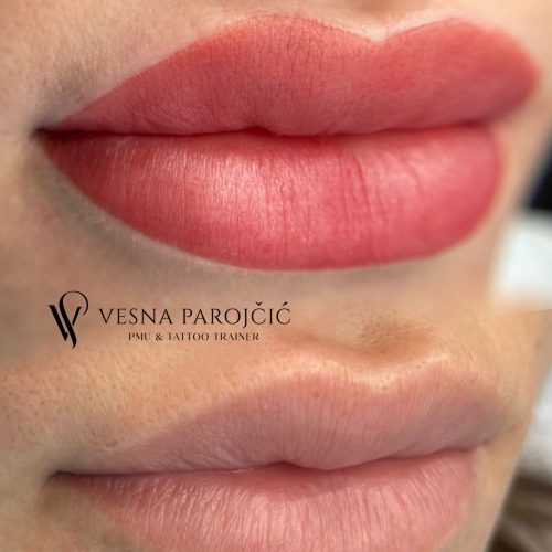 vpmc vpmc